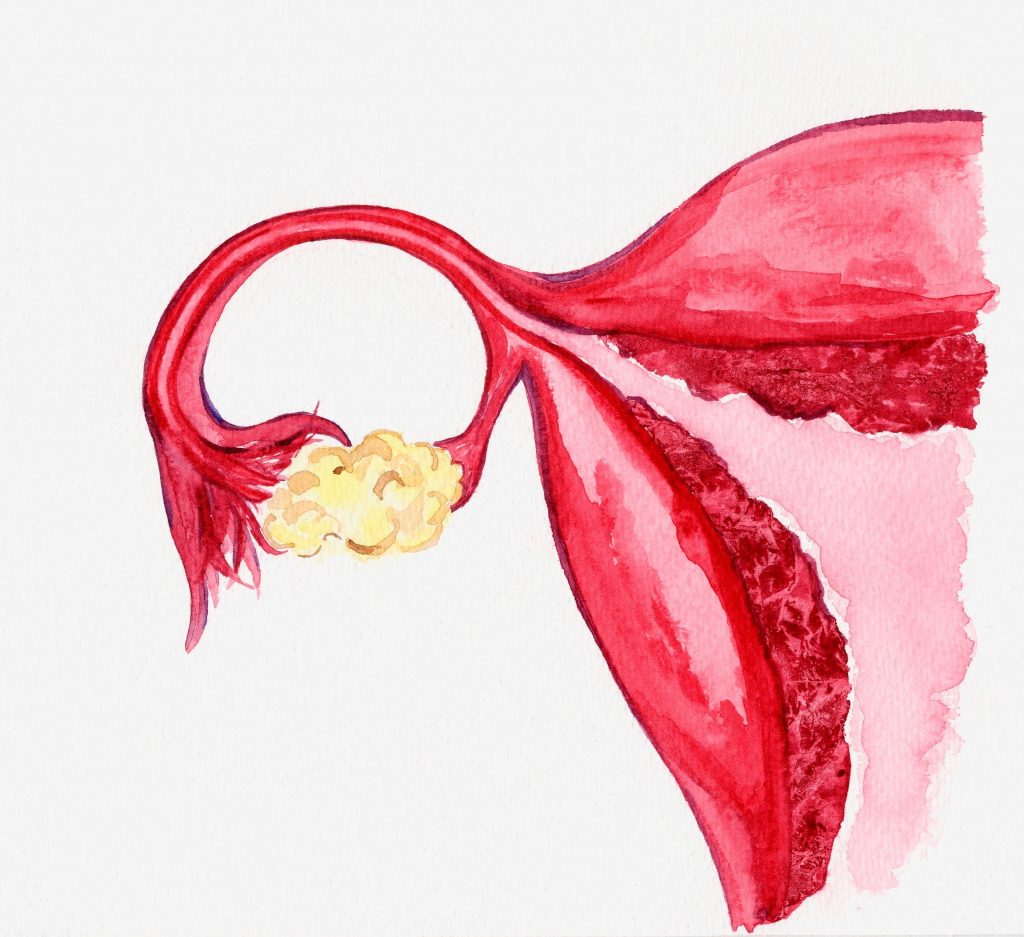 Right Fallopian tube by Susan Lockhart